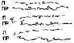 9.gif